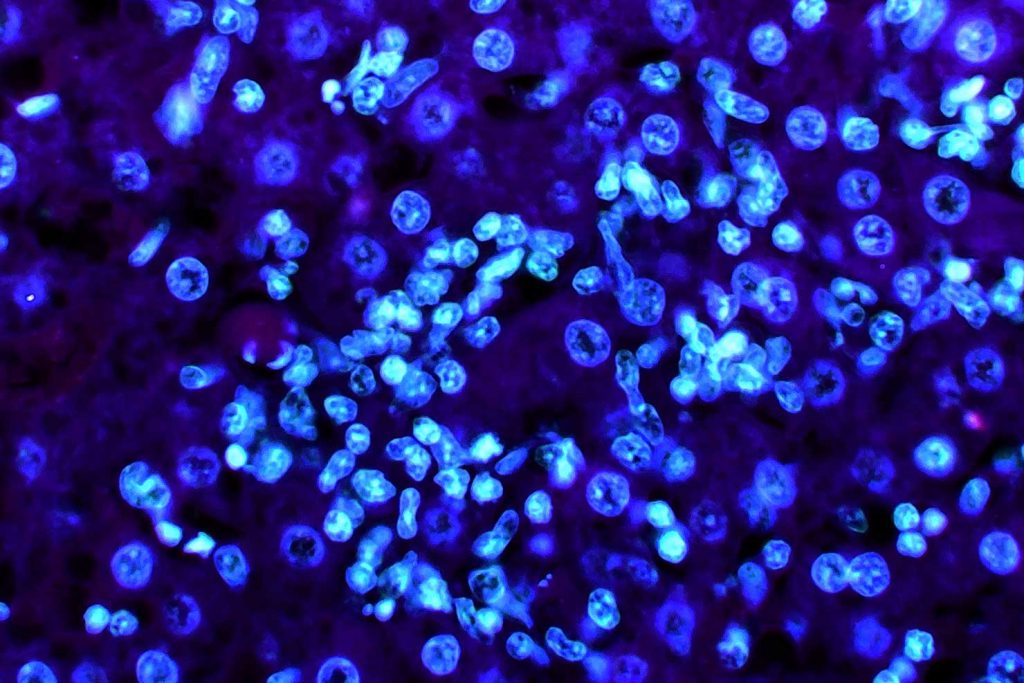 MICROBIOME, bacteria